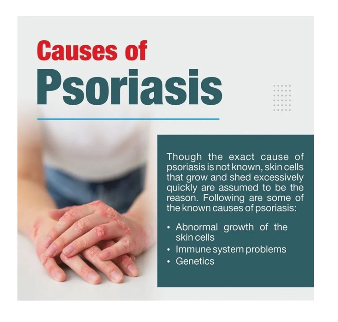 GET RID OF PSORIASIS SKIN DISEASE - REDUCE SCALING & ITCHING - STOP PAIN NOW - MADE IN USA