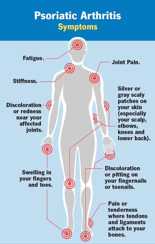 GET RID OF PSORIASIS SKIN DISEASE - REDUCE SCALING & ITCHING - STOP PAIN NOW - MADE IN USA