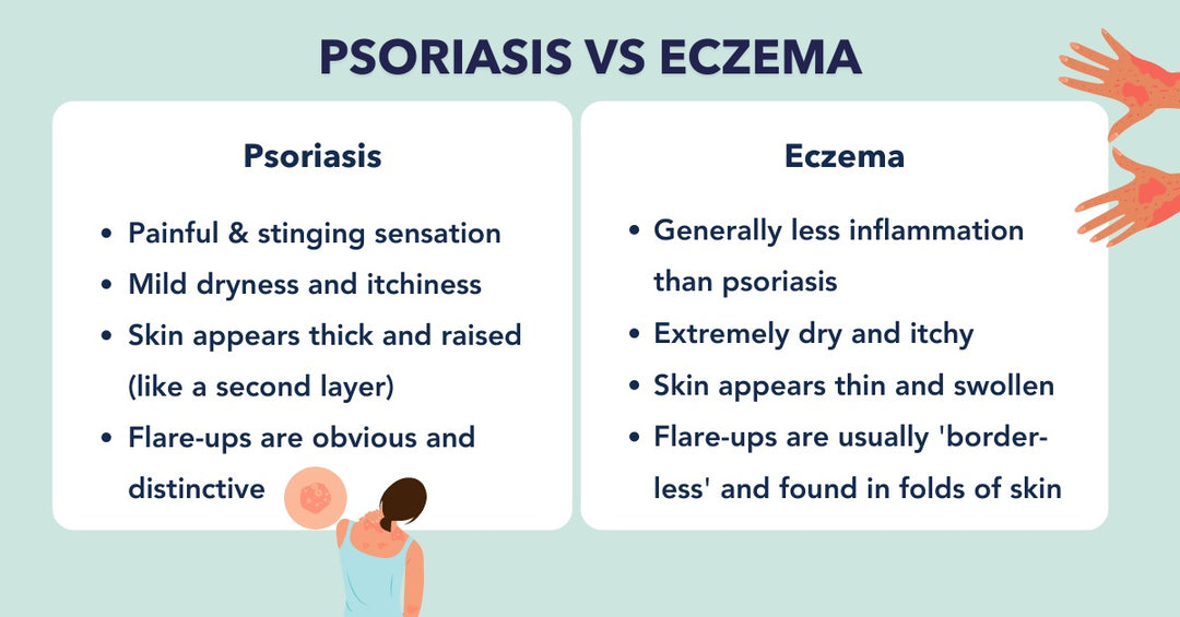 GET RID OF ECZEMA, ROSACEA & PSORIASIS NATURALLY - Prevent and Treat - MADE IN USA