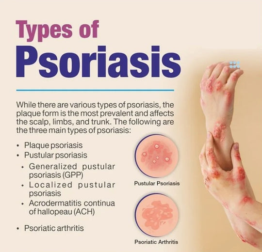 GET RID OF PSORIASIS SKIN DISEASE - REDUCE SCALING & ITCHING - STOP PAIN NOW - MADE IN USA