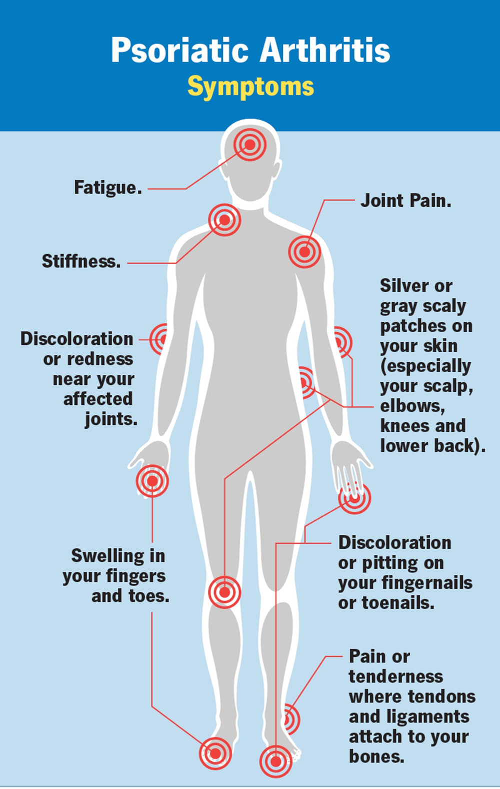 STOP PSORIATIC ARTHRITIS PAIN NATURALLY - STRONGEST PSORIATIC PAIN KILLER - MADE IN USA