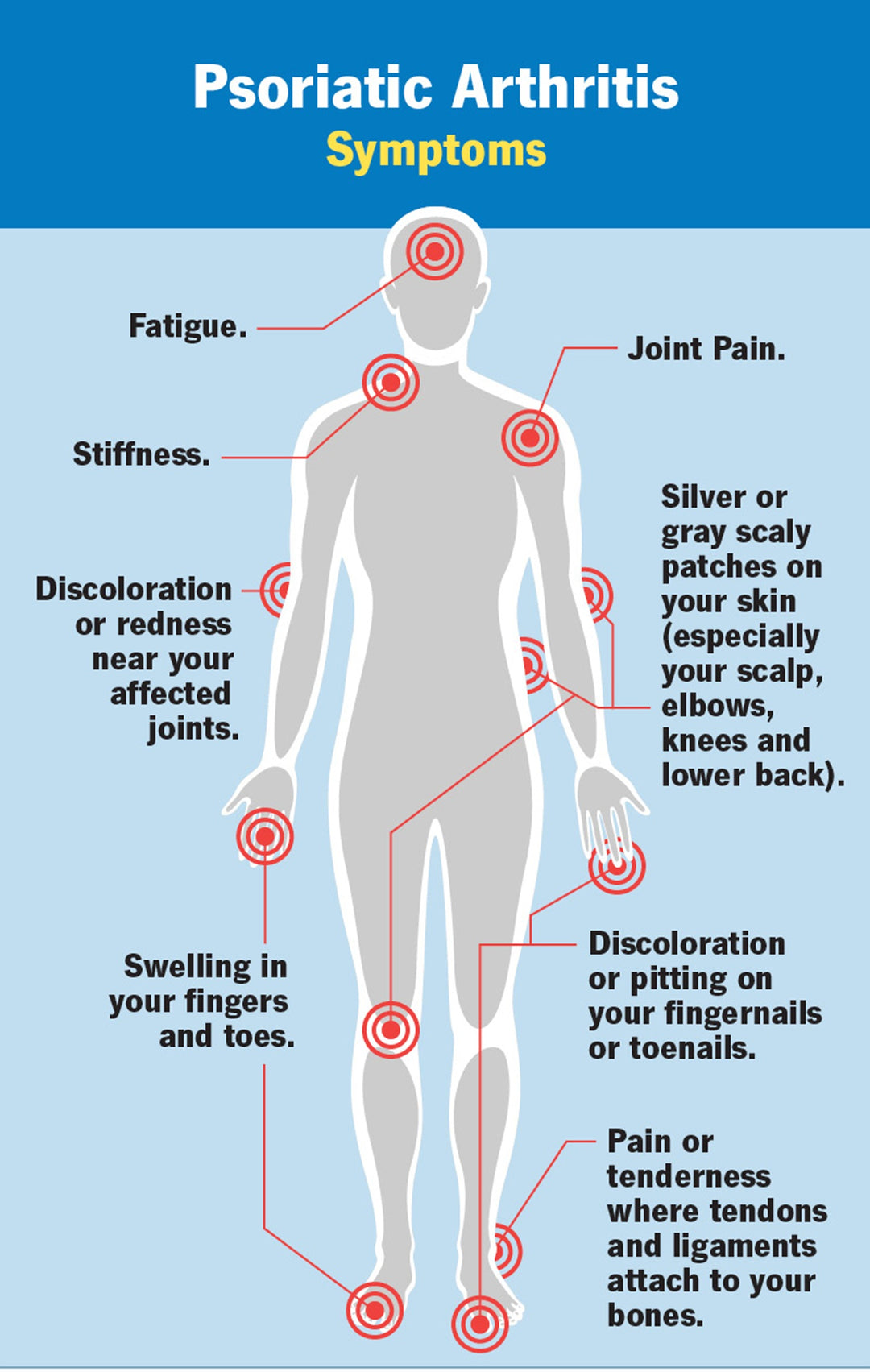 STOP PSORIATIC ARTHRITIS PAIN NATURALLY - STRONGEST PSORIATIC PAIN KILLER - MADE IN USA
