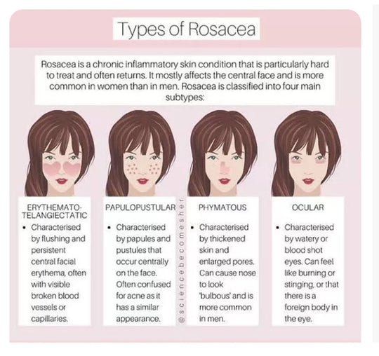GET RID OF ROSACEA SKIN DISEASE - REDUCE SCALING & ITCHING - MADE IN USA
