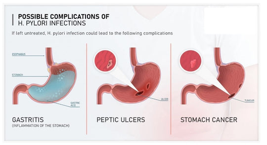 ELIMINATE STOMACH BACTERIA H PYLORI RIGHT AWAY - STRONGEST HERBAL FORMULA - GUMMIES - M ADE IN USA