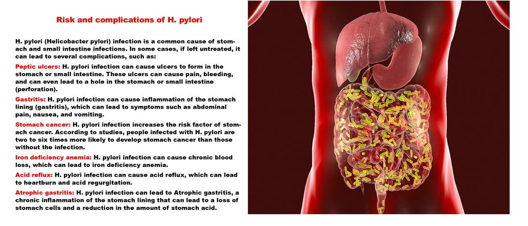 ELIMINATE STOMACH BACTERIA H PYLORI RIGHT AWAY - STRONGEST HERBAL FORMULA - GUMMIES - M ADE IN USA