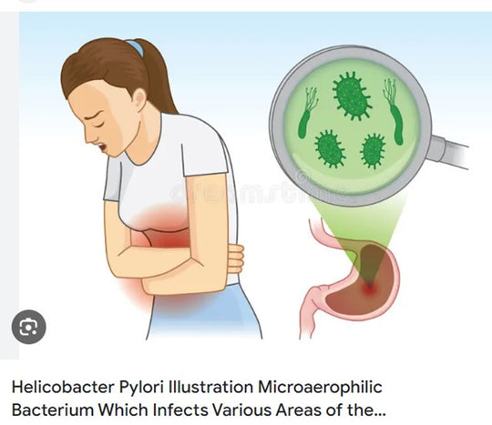 STOP STOMACH BACTERIA PAIN FOREVER - STRONGEST PAIN KILLER OF H. PYLORI PAIN MADE IN USA