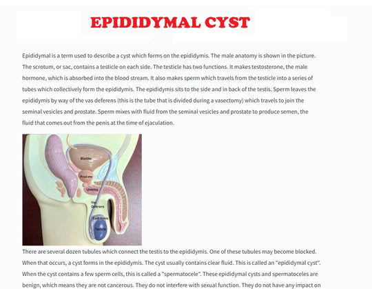 STOP CYST PAIN NOW - STRONGEST PAIN KILLER FRO CYSTS - MADE IN USA