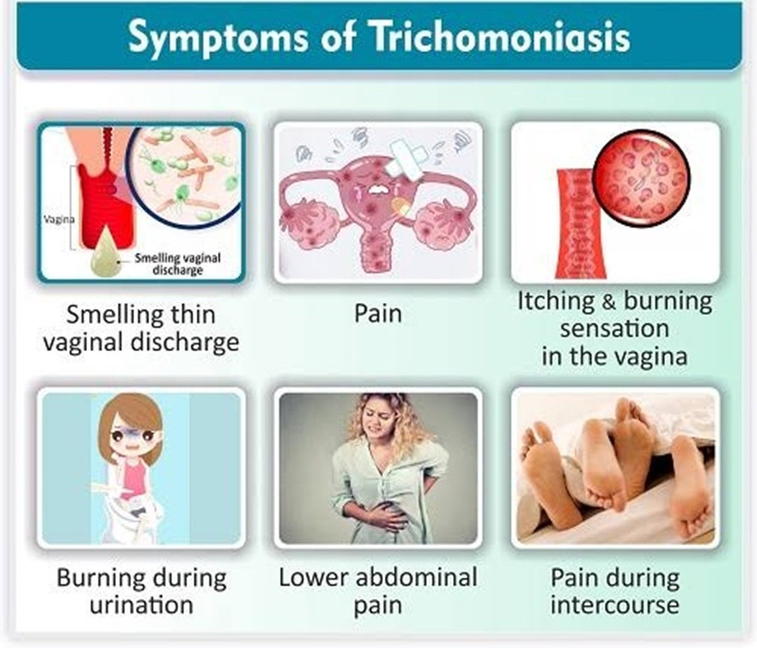GET RID OF TRICHOMONIASIS VAGINALIS FOR WOMEN AND MEN - ELIMINATE TRICHOMONAS VAGINALIS RIGHT NOW - MASDE IN USA