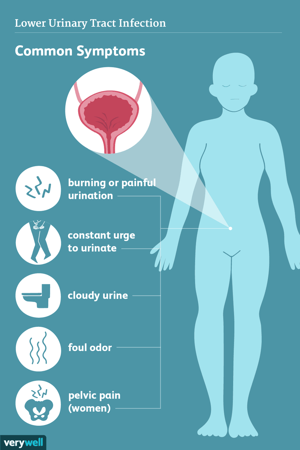 STOP URINARY TRACT INFECTION PAIN- STRONGEST URINARY INFECTION PAIN KILLER - MADE IN USA