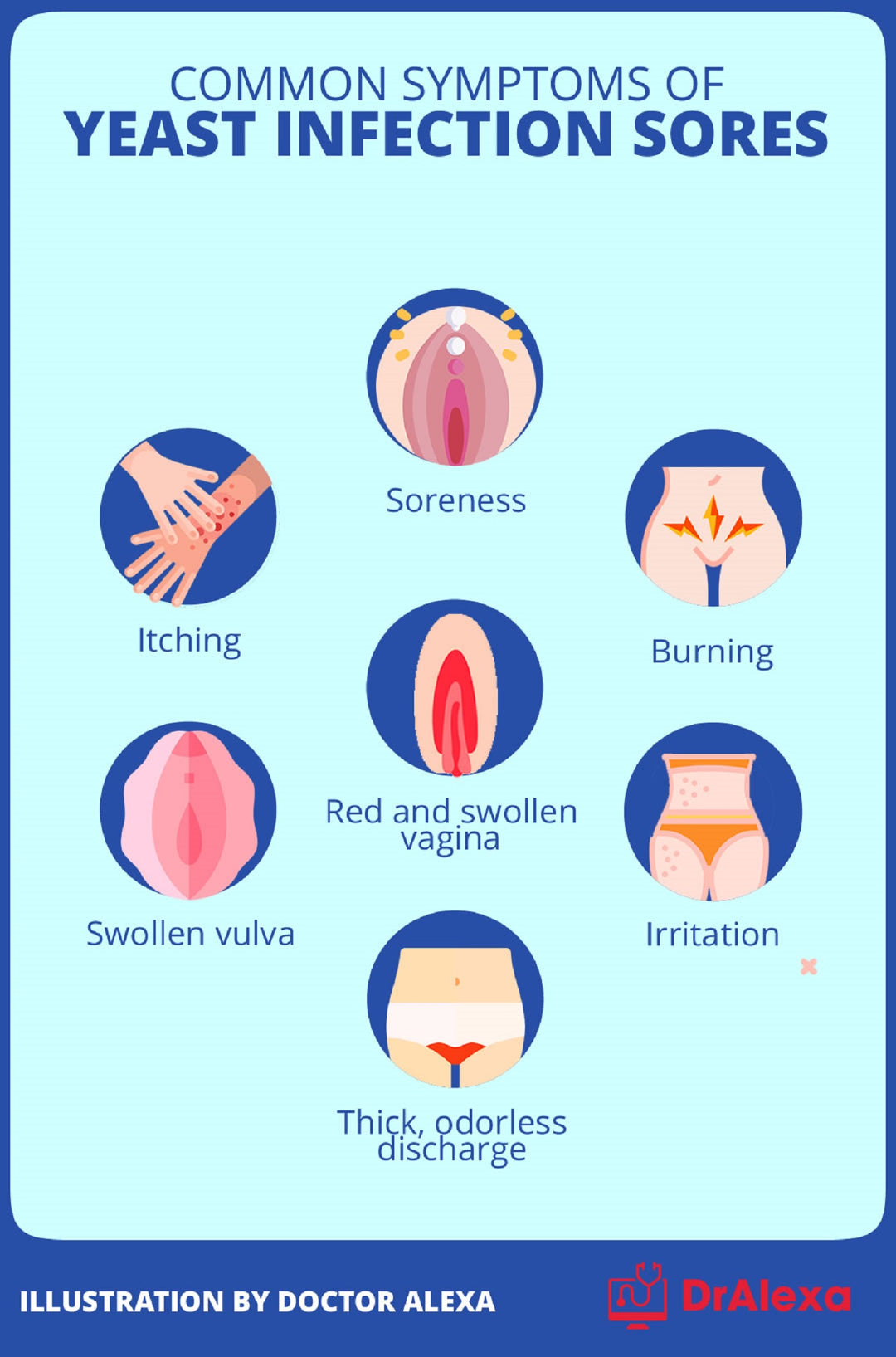 ELIMINAR LOS HONGOS VAGINALES Y CANDIDIASIS - matar los hongos y candidiasis naturalmente - MADE IN USA