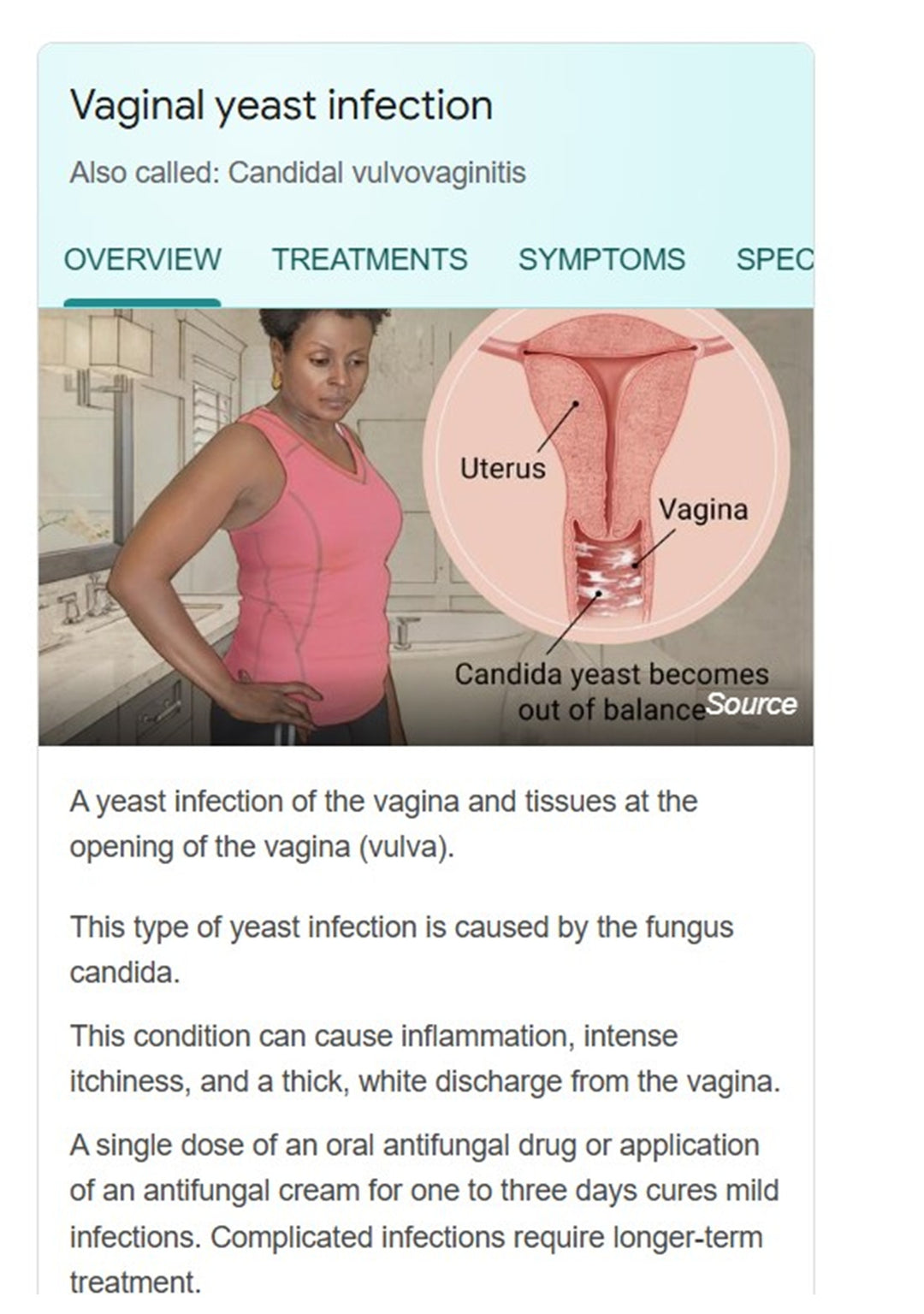 ELIMINAR LOS HONGOS VAGINALES Y CANDIDIASIS - matar los hongos y candidiasis naturalmente - MADE IN USA