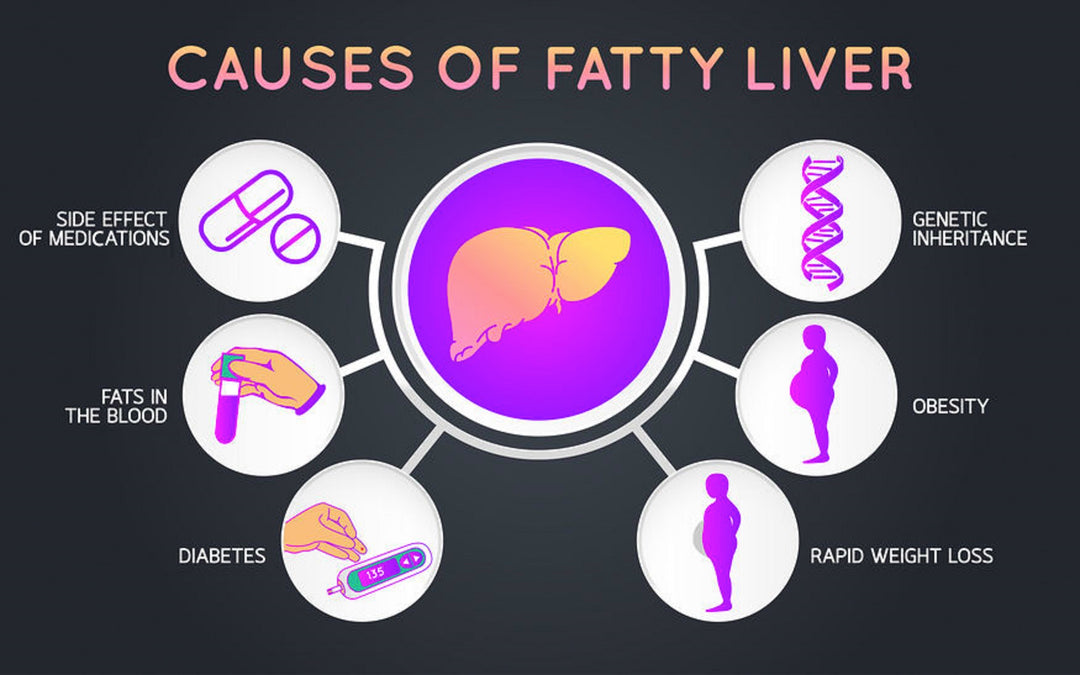 GET RID OF FATTY LIVER NATURALLY -  WOMEN & MEN - ELIMINATE FATTY LIVER - MADE