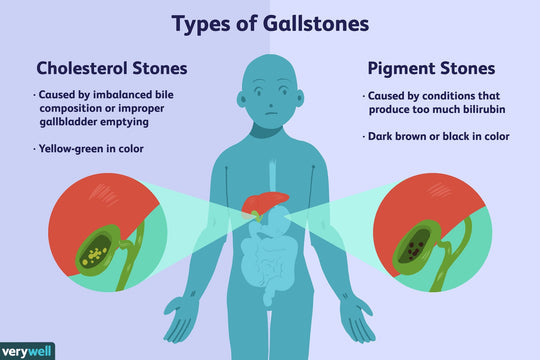 GET RID OF GALLBLADDER STONES & KIDNEY STONES - HERBAL STONES BREAKER - MADE IN USA