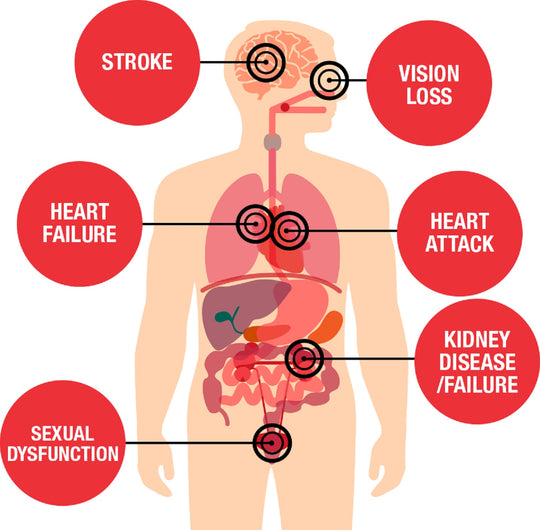 GET RID OF HIGH BLOOD PRESSURE NATURALLY - Lower BP Naturally - ELIMINATE Hypertension - MADE IN USA