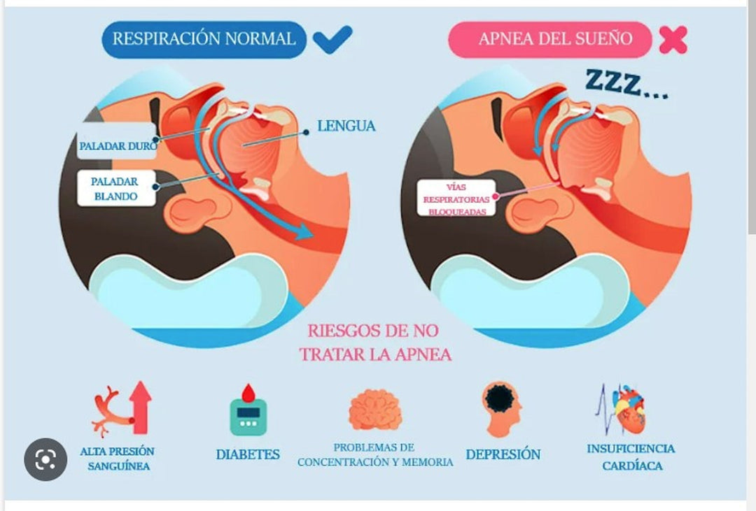 STOP SLEEP APNEA & SNORING RIGHT AWAY - GET RID OF SLEEP APNEA & SNORING NATURALLY - MADE IN USA