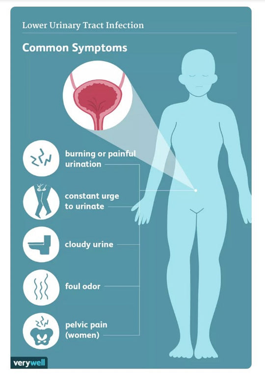 GET RID OF URINARY TRACT INFECTION (UTI) - URINARY BACTERIAL INFECTION KILLER - TREAT & PREVENT - MADE IN USA