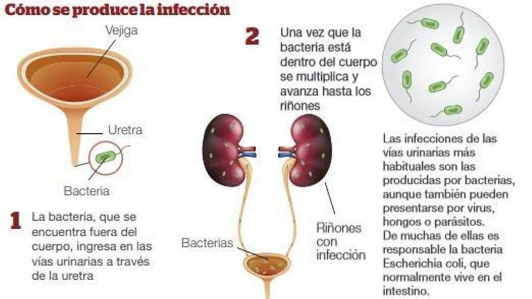 GET RID OF URINARY TRACT INFECTION (UTI) - URINARY BACTERIAL INFECTION KILLER - TREAT & PREVENT - MADE IN USA