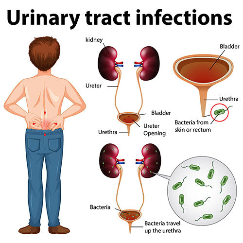 GET RID OF ANY BACTERIAL INFECTION FOR MEN & WOMEN - BACTERIUM KILLER - MADE IN USA