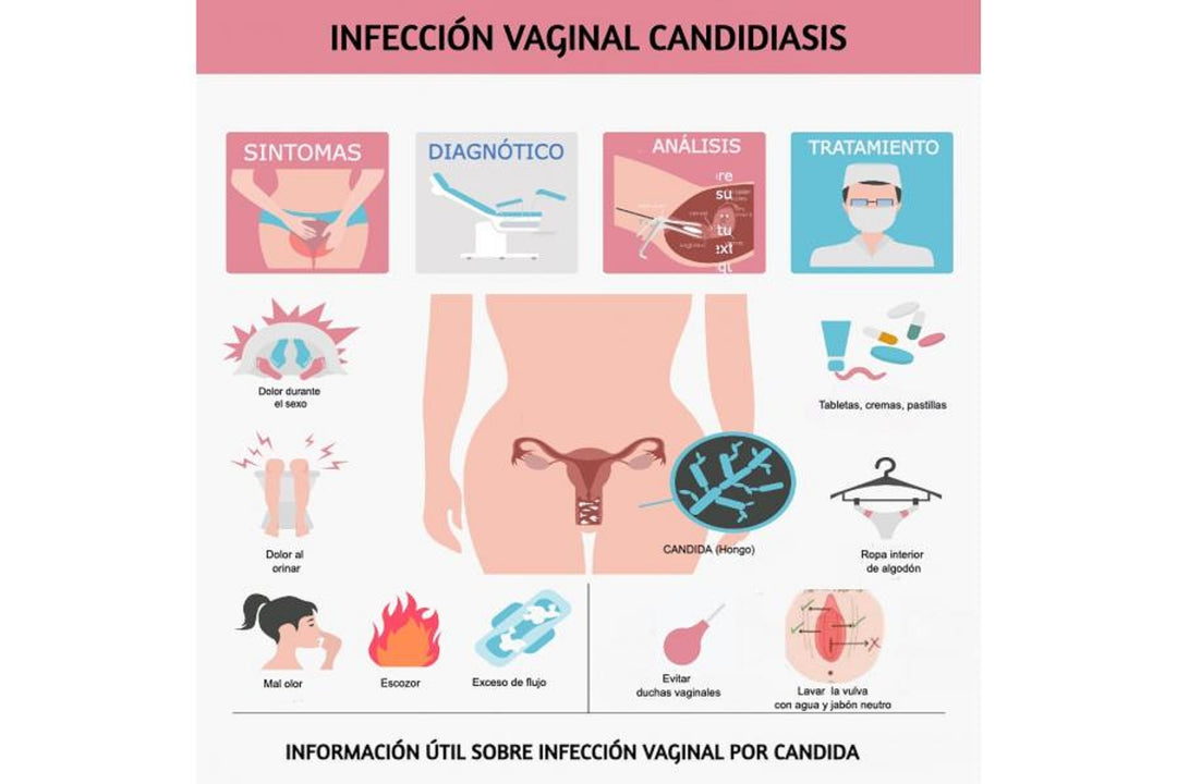 CANDIDIASIS FUNGUS KILLER - Prevent and Treat