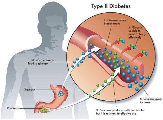 DIABETES - HIGH BLOOD SUGAR - TEAT & PREVENT