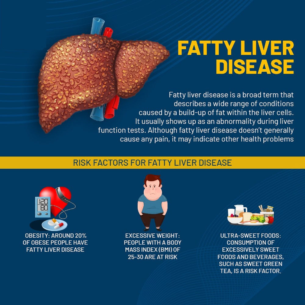 FATTY LIVER -  WOMEN & MEN - to Treat and Prevent