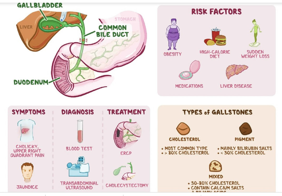 GALLBLADDER STONE BREAKER to Treat & Prevent