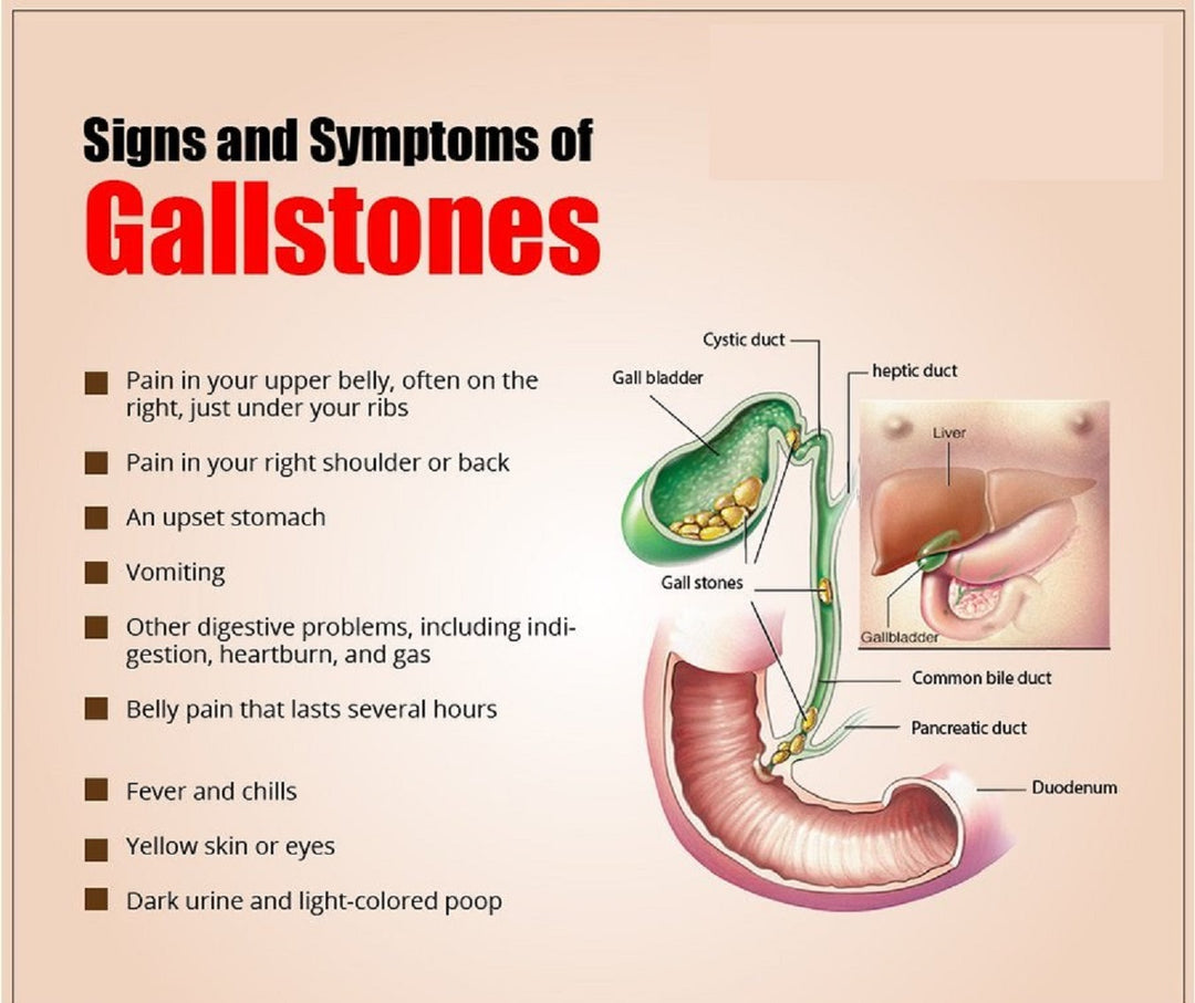 GALLBLADDER STONE BREAKER to Treat & Prevent