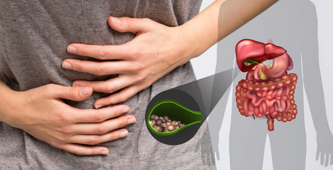 GALLBLADDER STONE BREAKER to Treat & Prevent