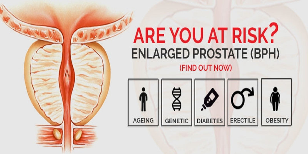 ENLARGED PROSTATE - BPH - to Treat and Prevent