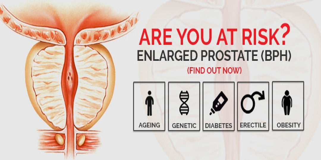 GET RID OF PROSTATITIS, EPIDIDYMITIS & ENLARGED PROSTATE NATURALLY - KILL ANY STIs BACTERIAL INFECTION - STRONGEST ANTI IFLAMMATORY  - MADE IN USA