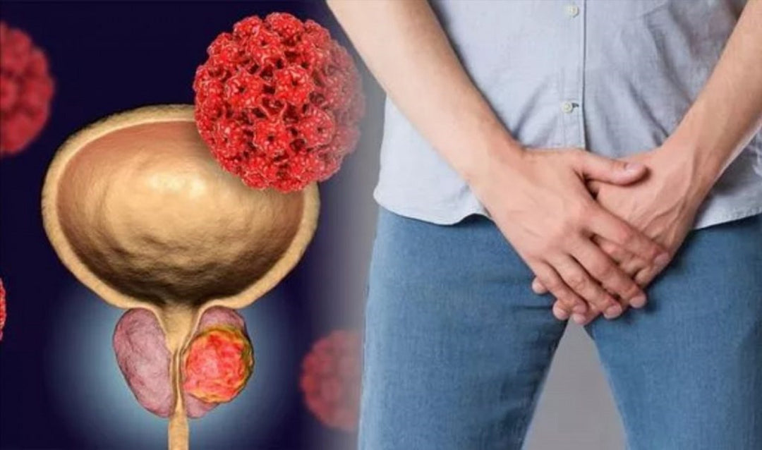 ELIMINAR LA EPIDIDIMITIS PROSTAT LARGA BPH & PROSTATITIS  - CURAR Y PREVENIR - MADE IN USA