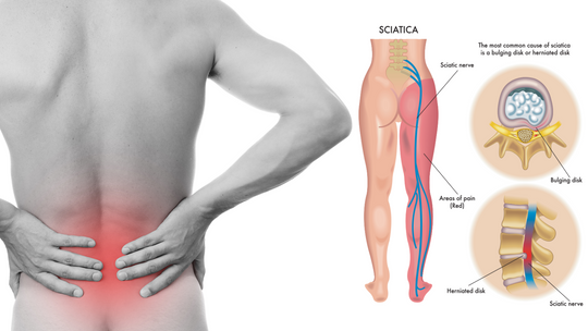 GET RID OF CHRONIC SCIATICA, HIP JOINT & ARTHRITIS PAIN - STOP ANY PAIN OF YOUR BODY - MADE IN USA