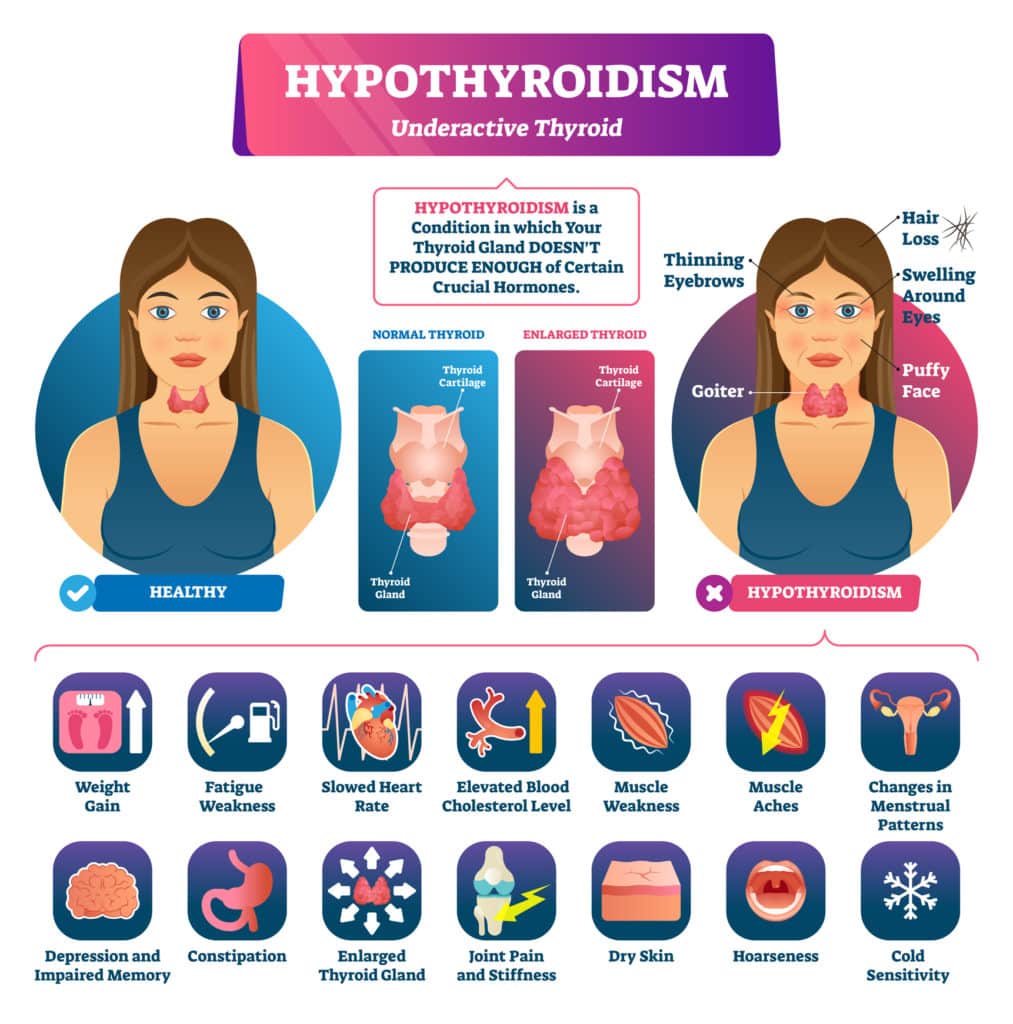 GET RID OF THYROID & ADRENAL Disease - Hypothyroidism - Thyroid Hormone Booster - MADE IN USA