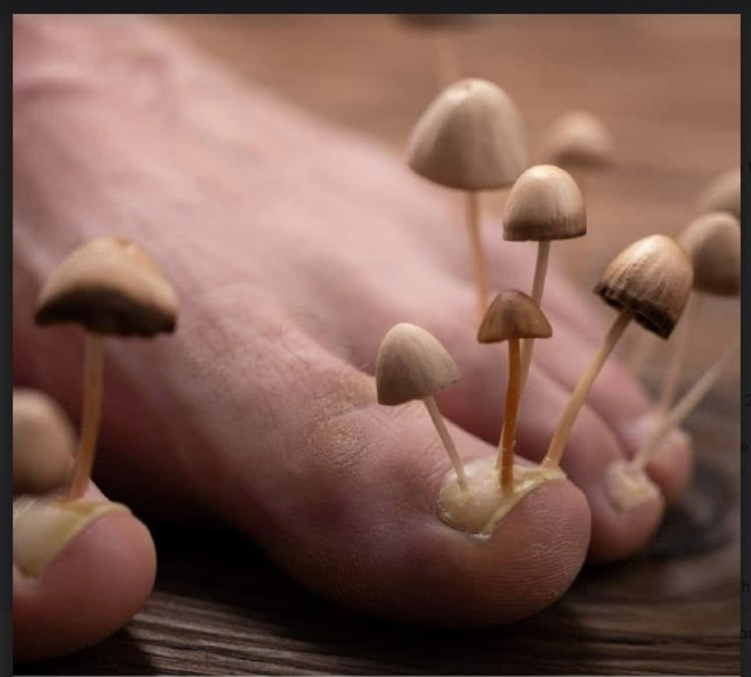 TOENAIL FUNGUS 4 ME - TO CURE, TREAT AND PREVENT