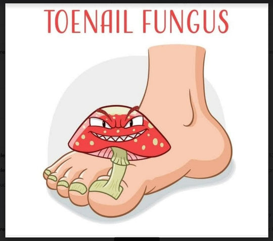 TOENAIL FUNGUS 4 ME - TO CURE, TREAT AND PREVENT