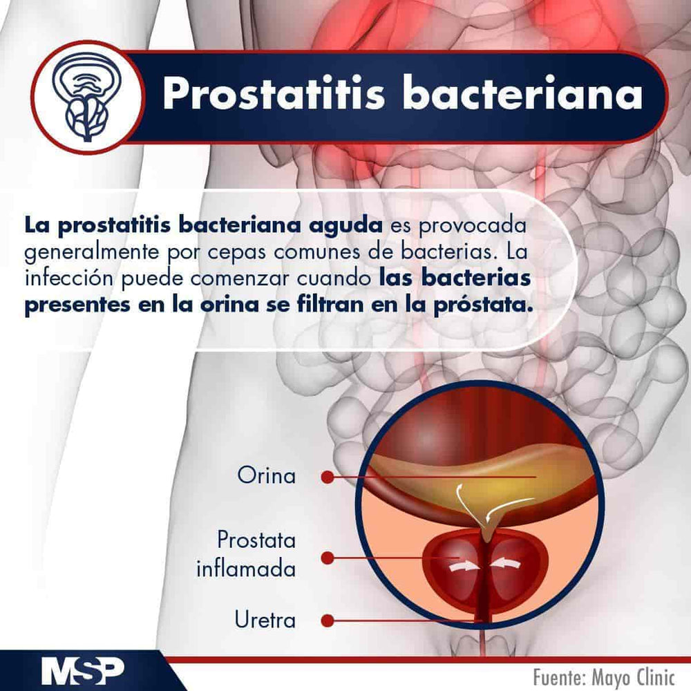 PROSTATITIS BACTERIAL - CHRONIC PROTATITIS - to Treat and Prevent