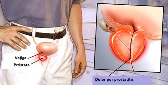 ELIMINAR LA EPIDIDIMITIS PROSTAT LARGA BPH & PROSTATITIS  - CURAR Y PREVENIR - MADE IN USA