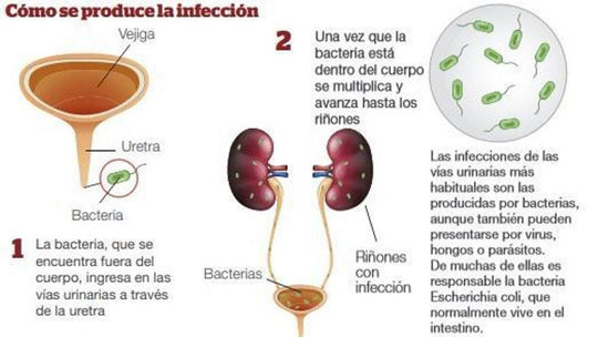 URINARY TRACT INFECTION 4 ME - UTI - MEN & WOMEN - TREAT & PREVENT